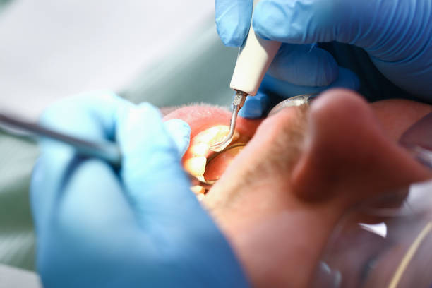 Best Chipped Tooth Repair Near Me  in Maggie Valley, NC