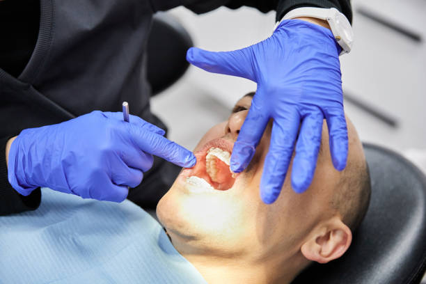 Best Emergency Dental Filling Replacement  in Maggie Valley, NC